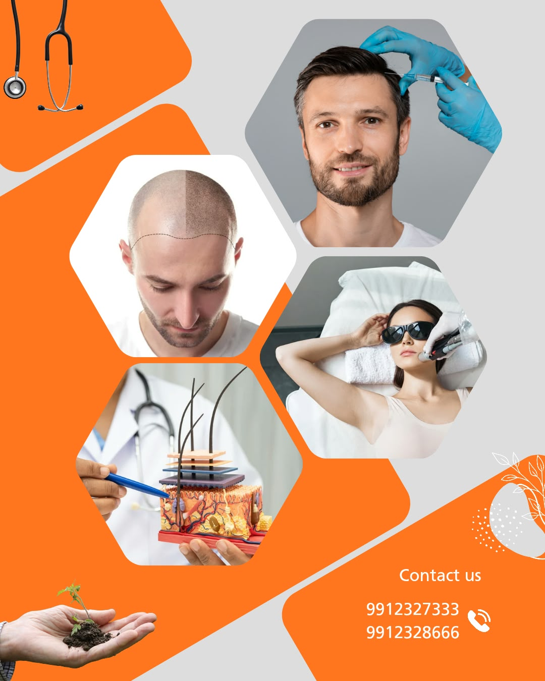 Universal Bio Hair Transplantation